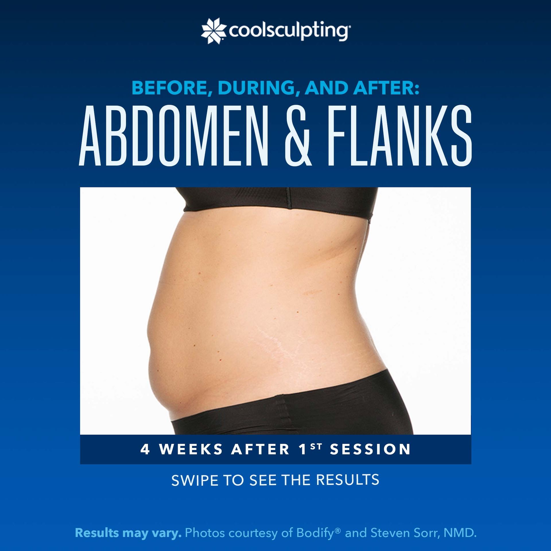 a before and after picture of a woman's abdomen and flanks for coolsculpting treatment