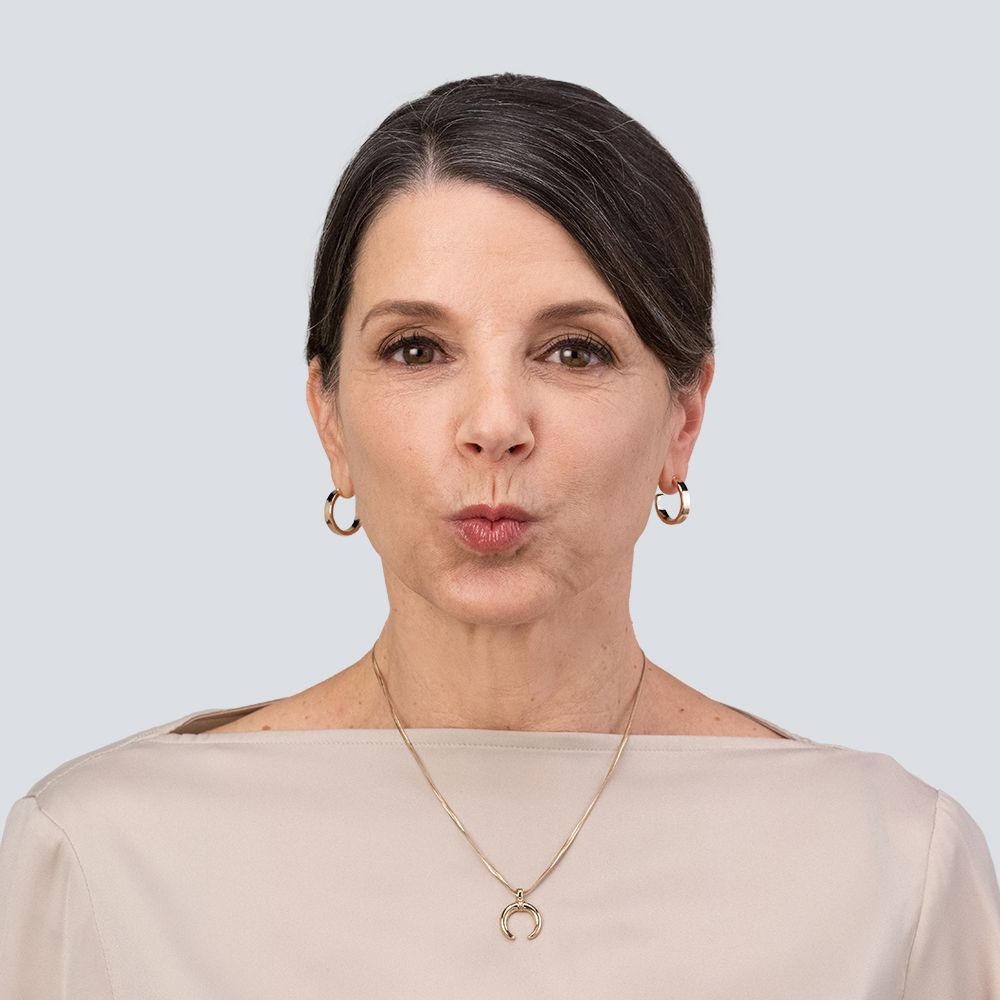 a woman's face before treatment with RHA collection of fillers
