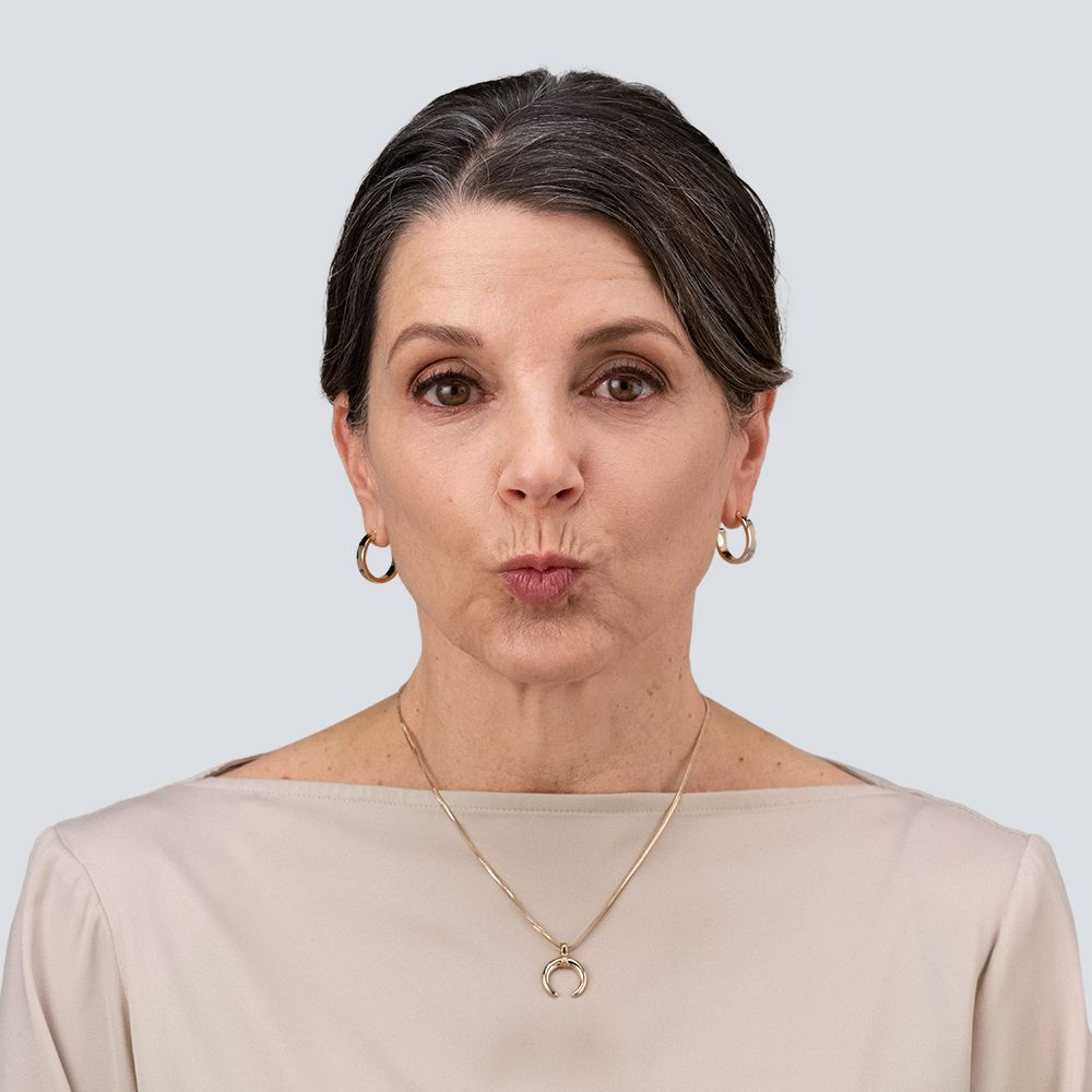 a woman's face before treatment with RHA collection of fillers