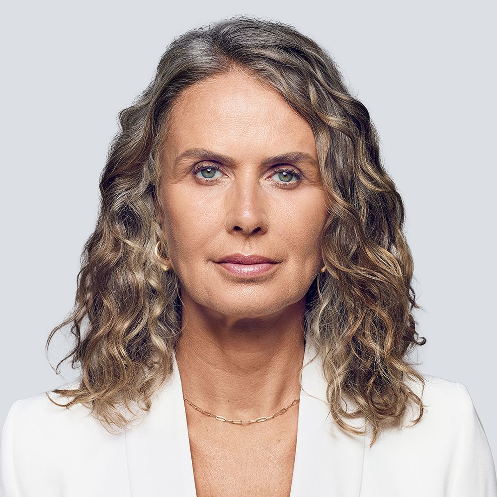 a woman's face after treatment with RHA collection of fillers
