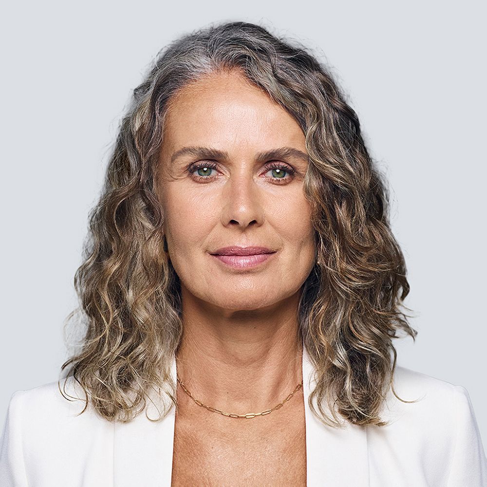 a woman's face before treatment with RHA collection of fillers
