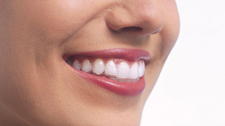 woman smiling