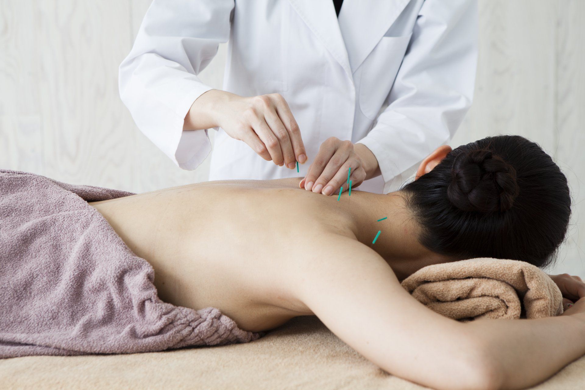 Person having acupuncture