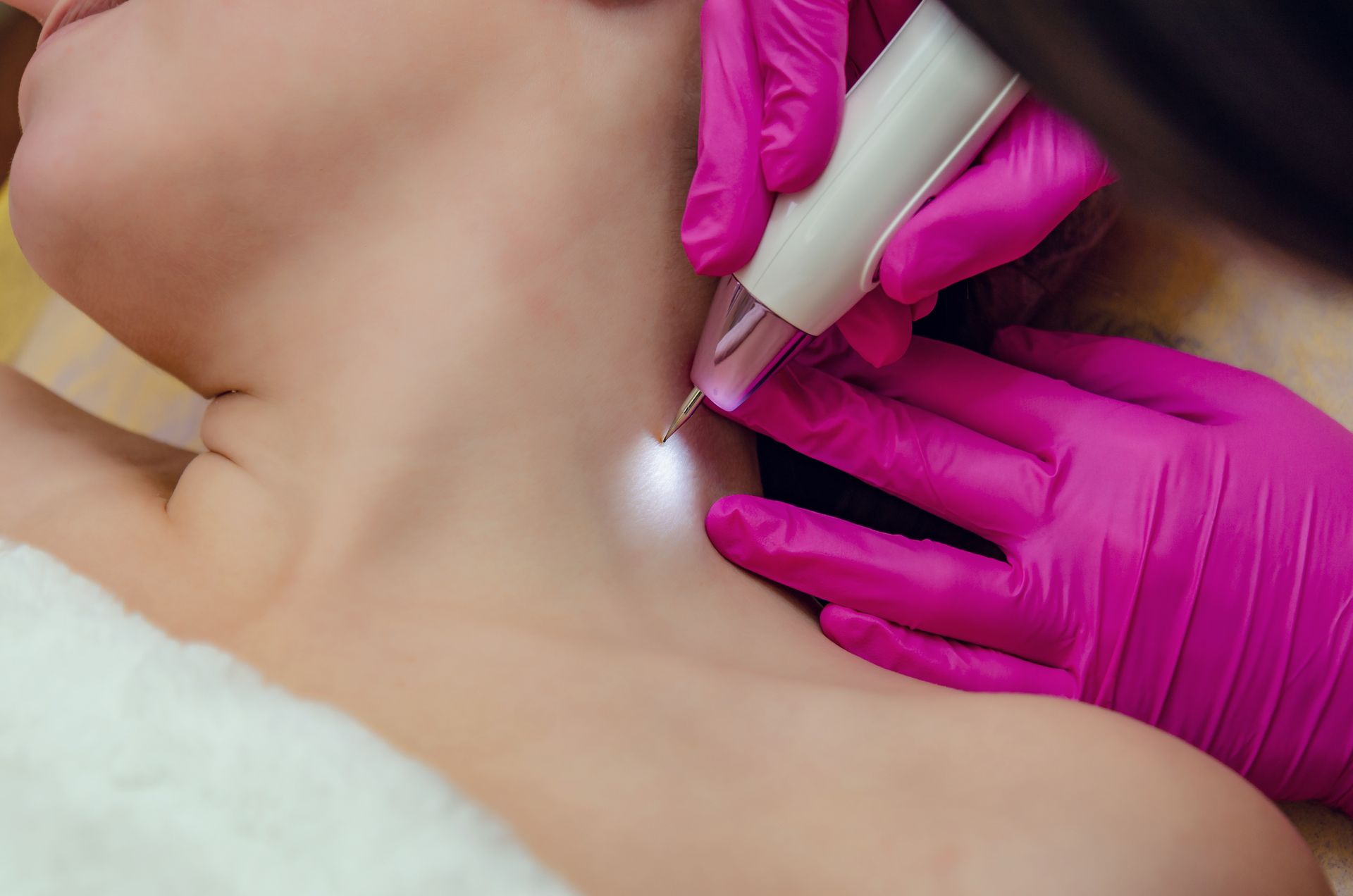 Gloved hands using a syringe on a person’s neck during a cosmetic injection procedure