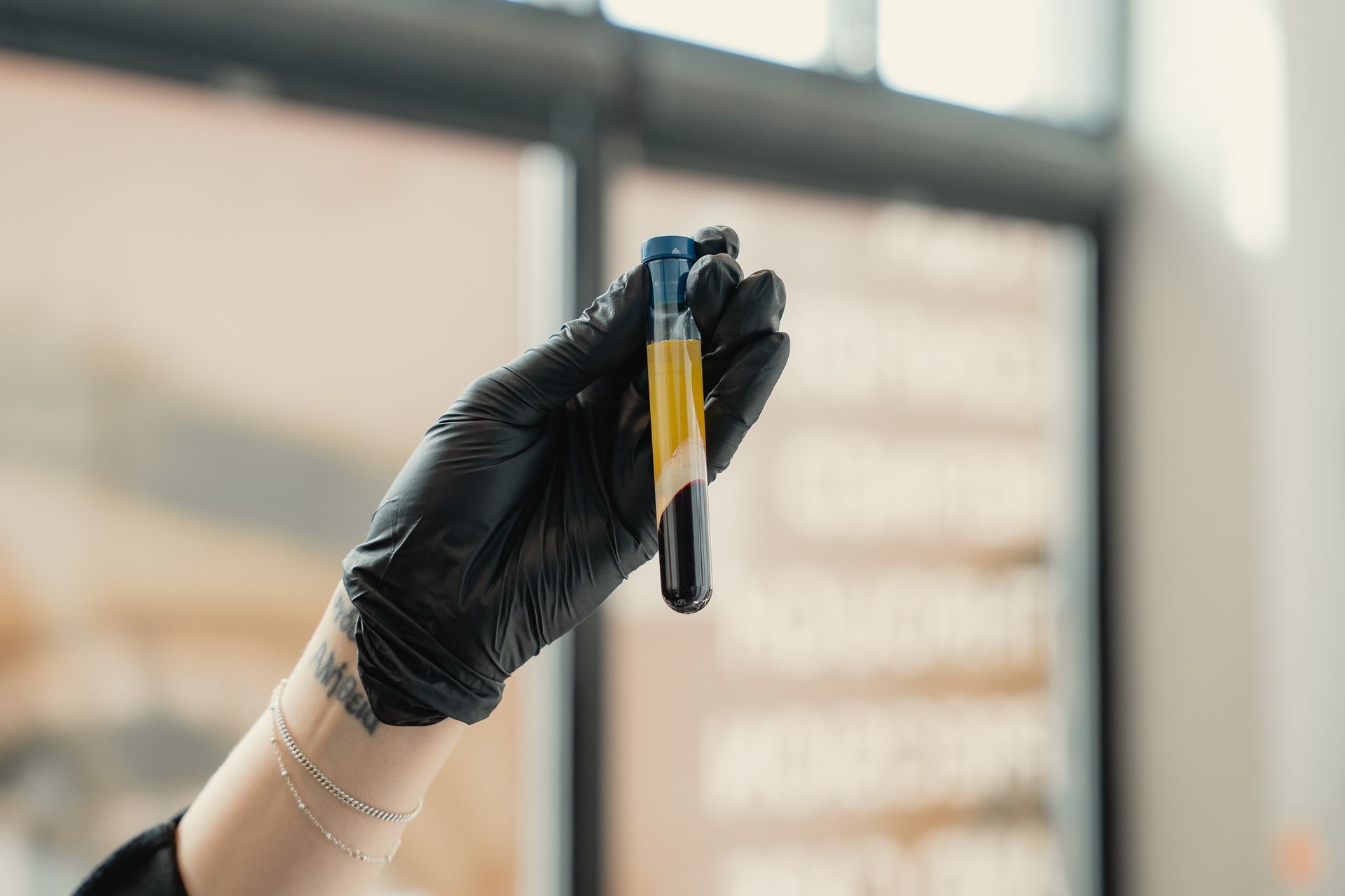 Person receiving a scalp injection; a healthcare worker with gloved hands.