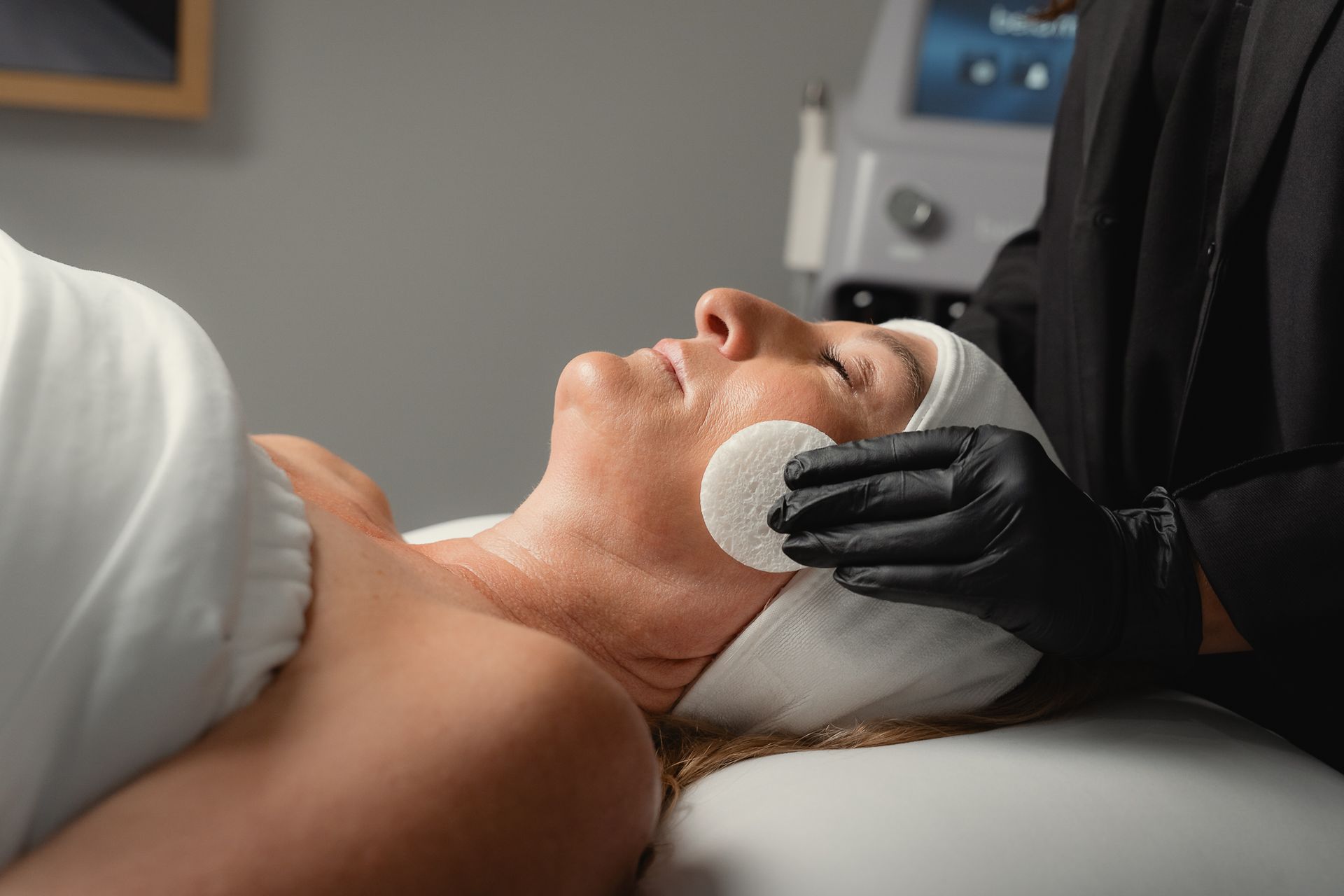 Chemical Peel