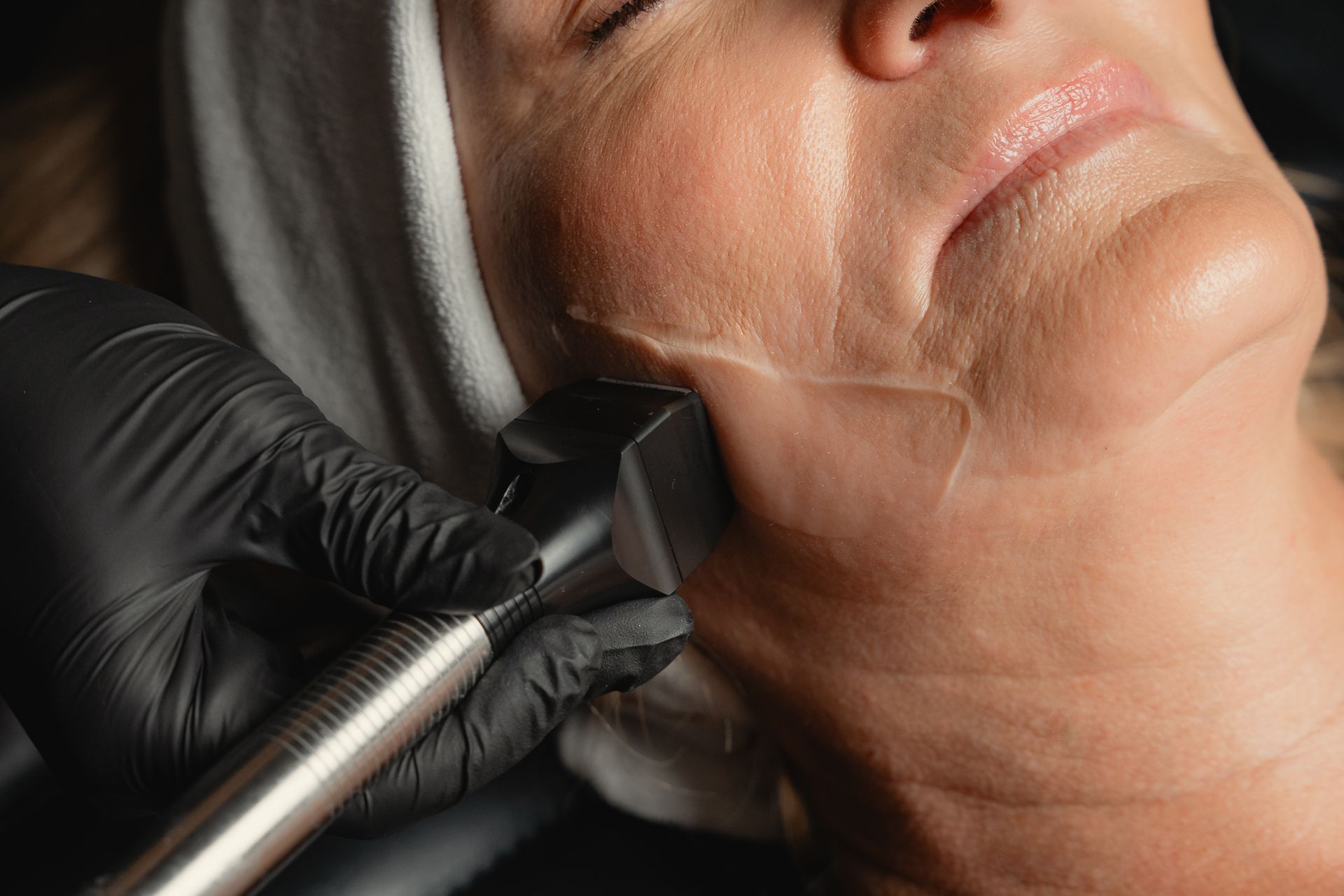 Woman receiving facial treatment with Forma RF