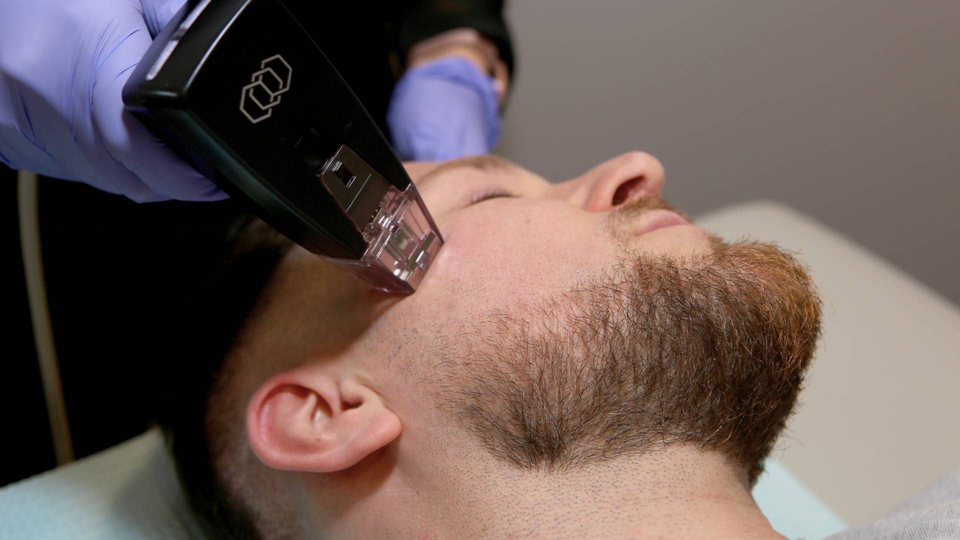Patient receiving tox on her forehead