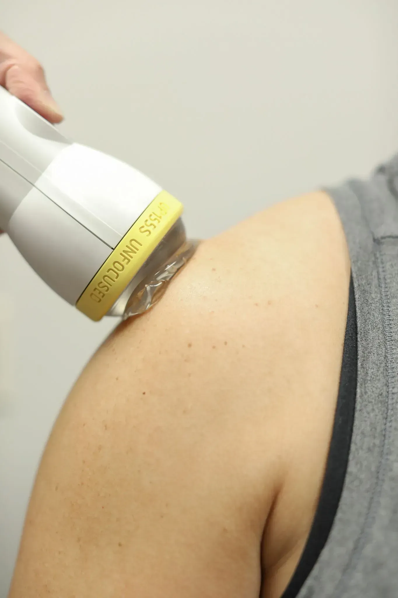 A medical device applying gel to a person's shoulder, likely for treatment or scanning.