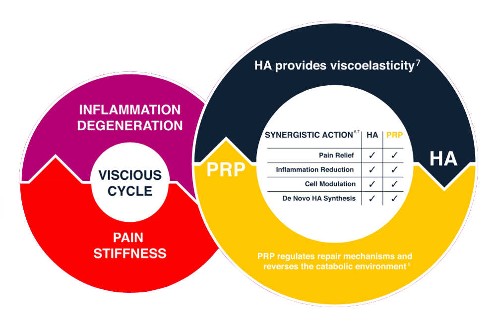 A diagram showing the process of inflammation degeneration and pain stiffness