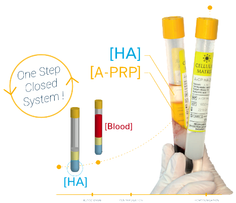 A person is holding a tube of ha and a tube of a-prp