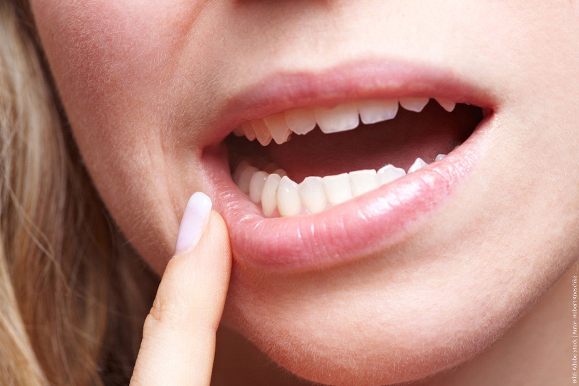 Eine Nahaufnahme des Mundes einer Frau mit dem Finger auf der Lippe.