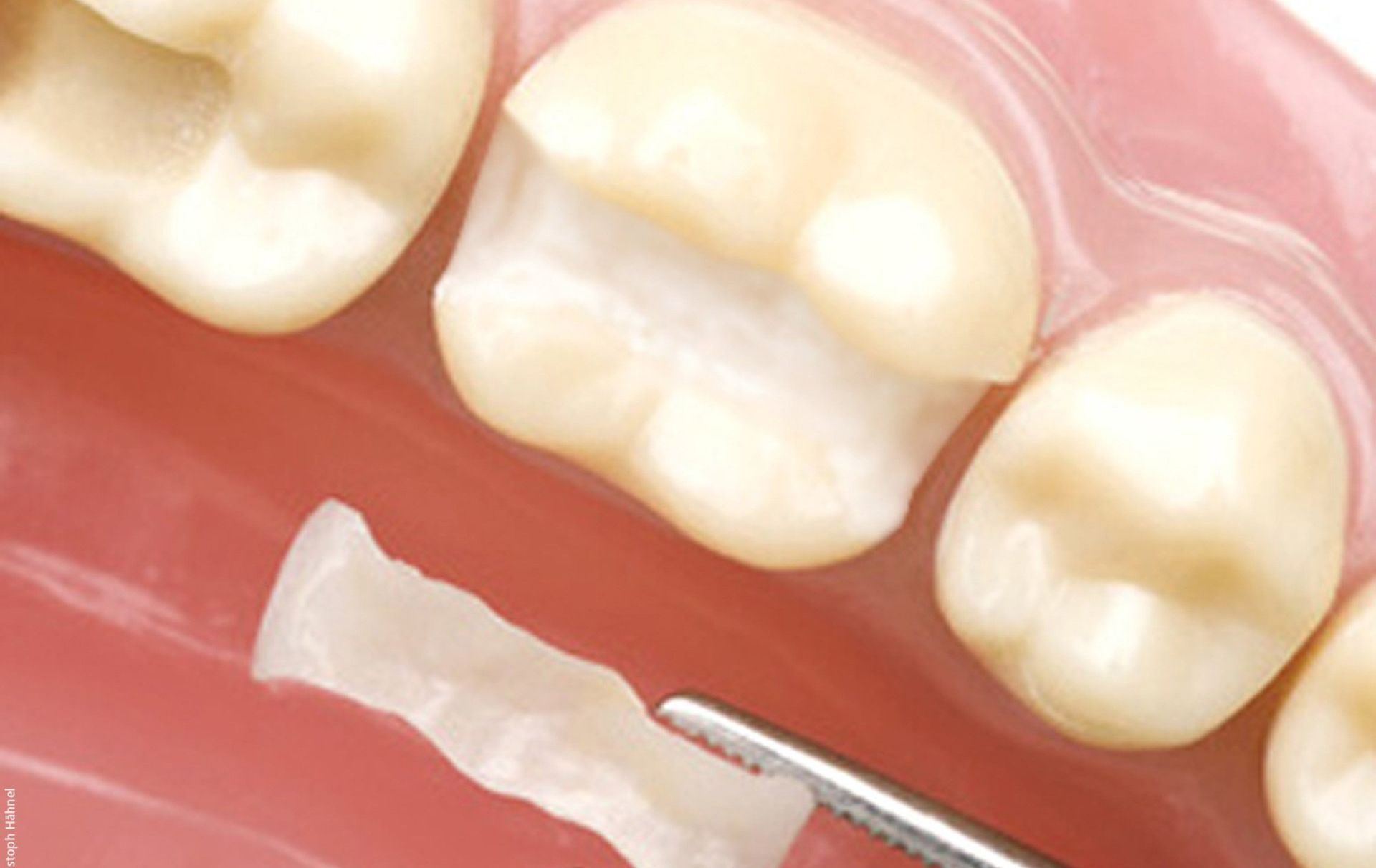 A close up of a person's teeth with a piece of paper between them.