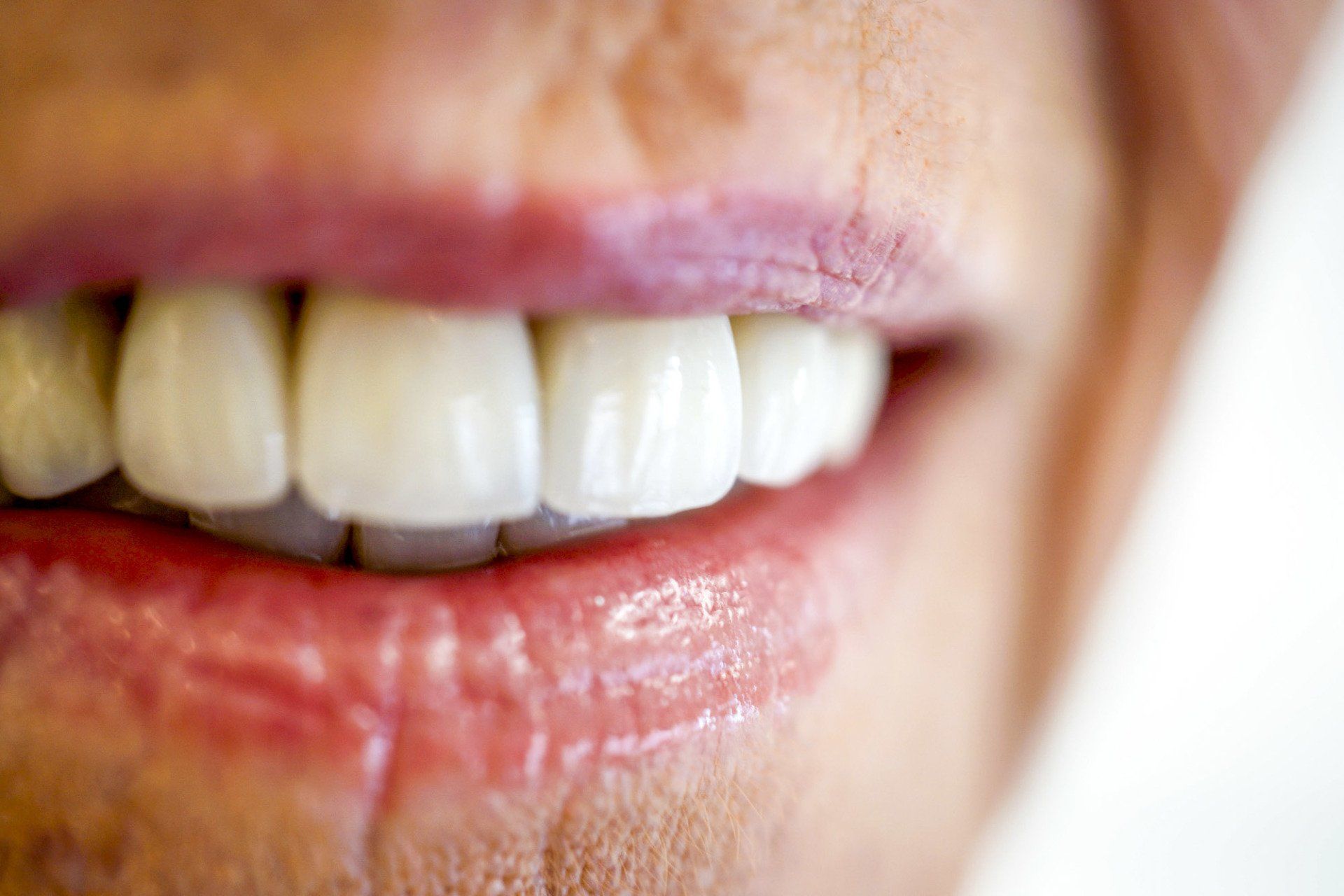 A close up of a person 's mouth with white teeth and red lips.