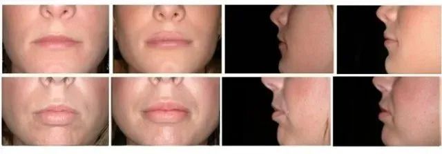 Close-up views of a person's lips and profile. One row shows the lips closed and the other, slightly parted.