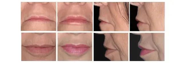 Close-up of 8 lip shapes, 4 top views, 4 side views. Varying colors, some fuller than others.
