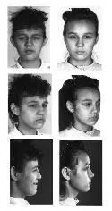 Pairs of black and white portraits, before and after, of a person.