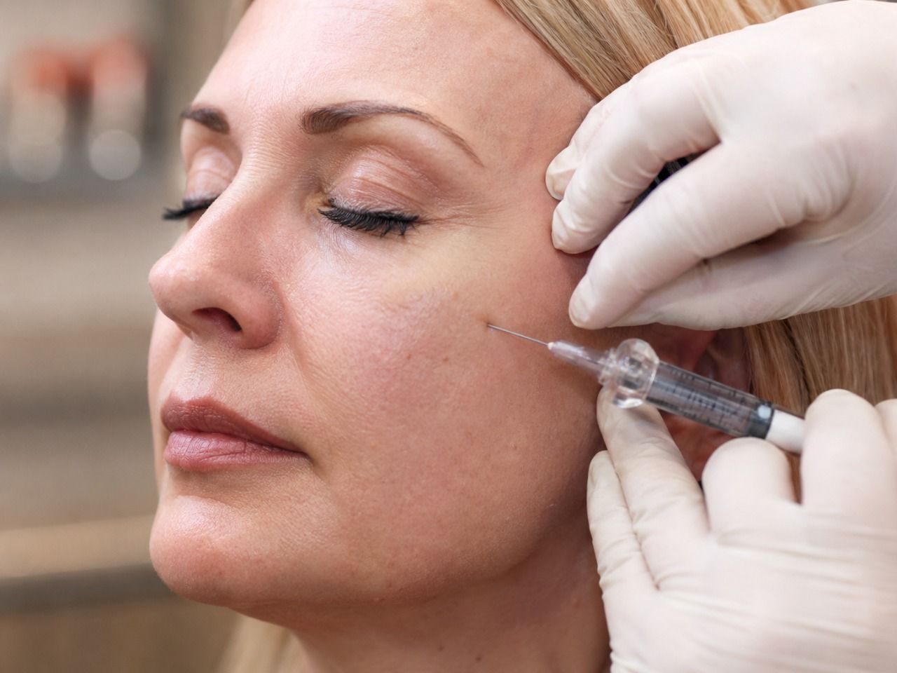 What Is Sculptra?