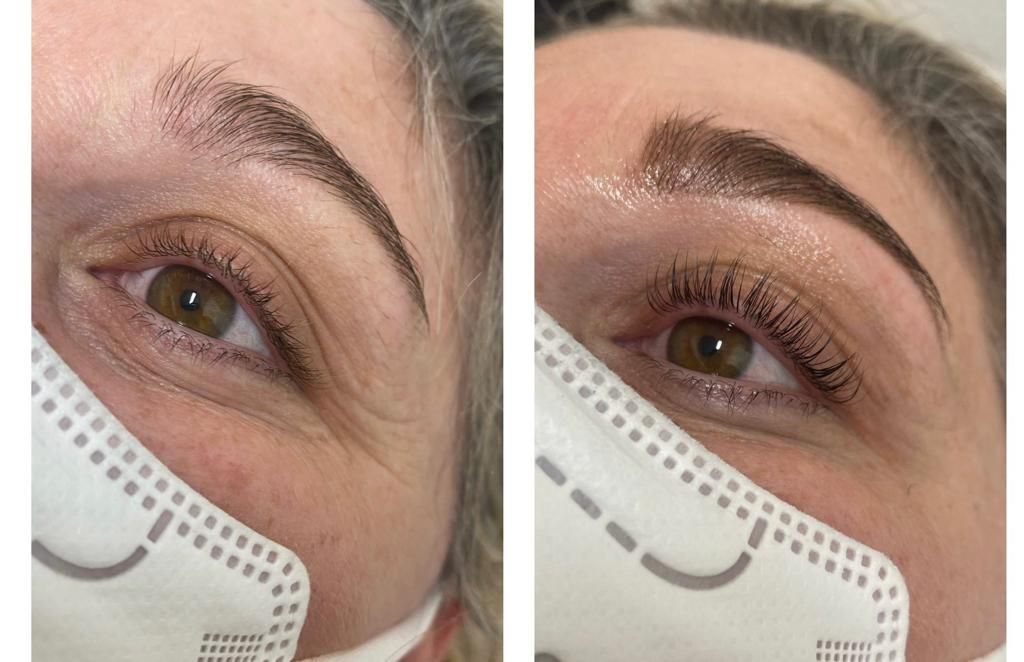 Una foto prima e dopo di una donna che indossa una maschera.