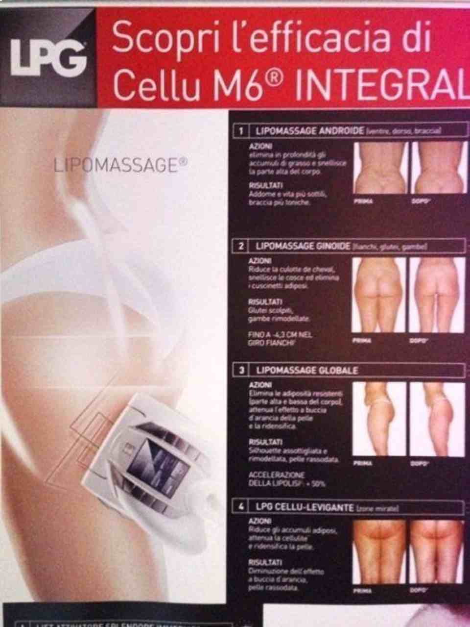 Lipomassage