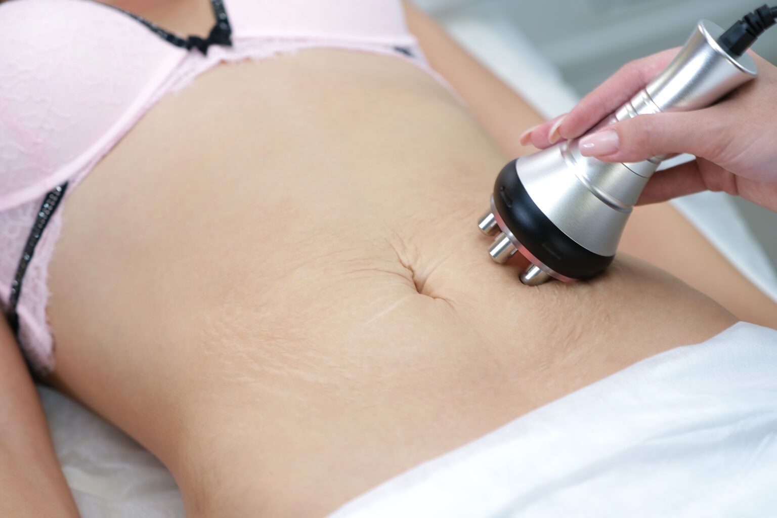 woman-getting-skin-tightening