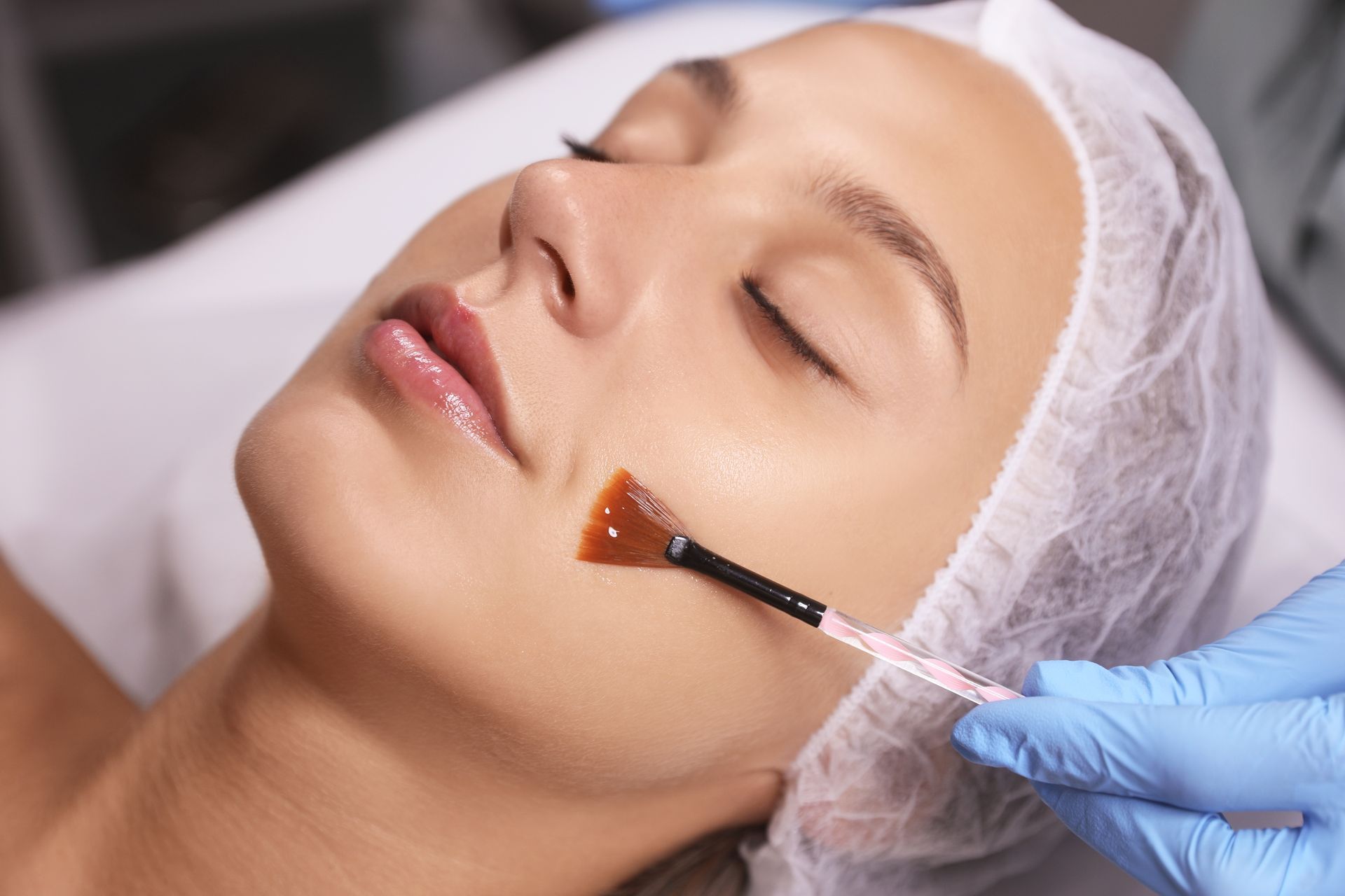 Close-up of a person receiving a microneedling treatment with a handheld device on the cheek