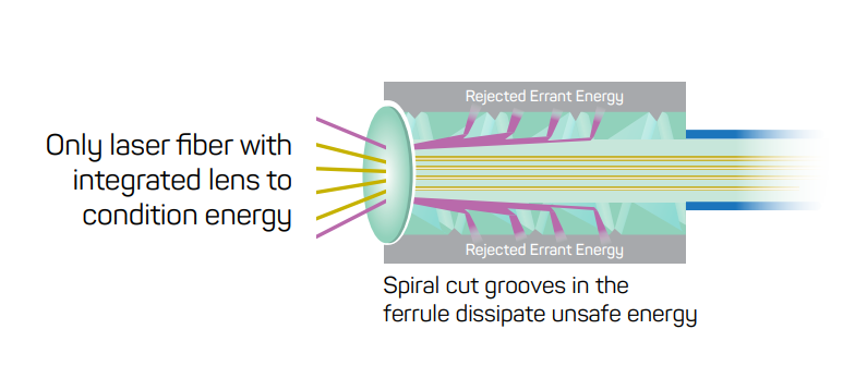 A diagram of a laser fiber with integrated lenses to condition energy.