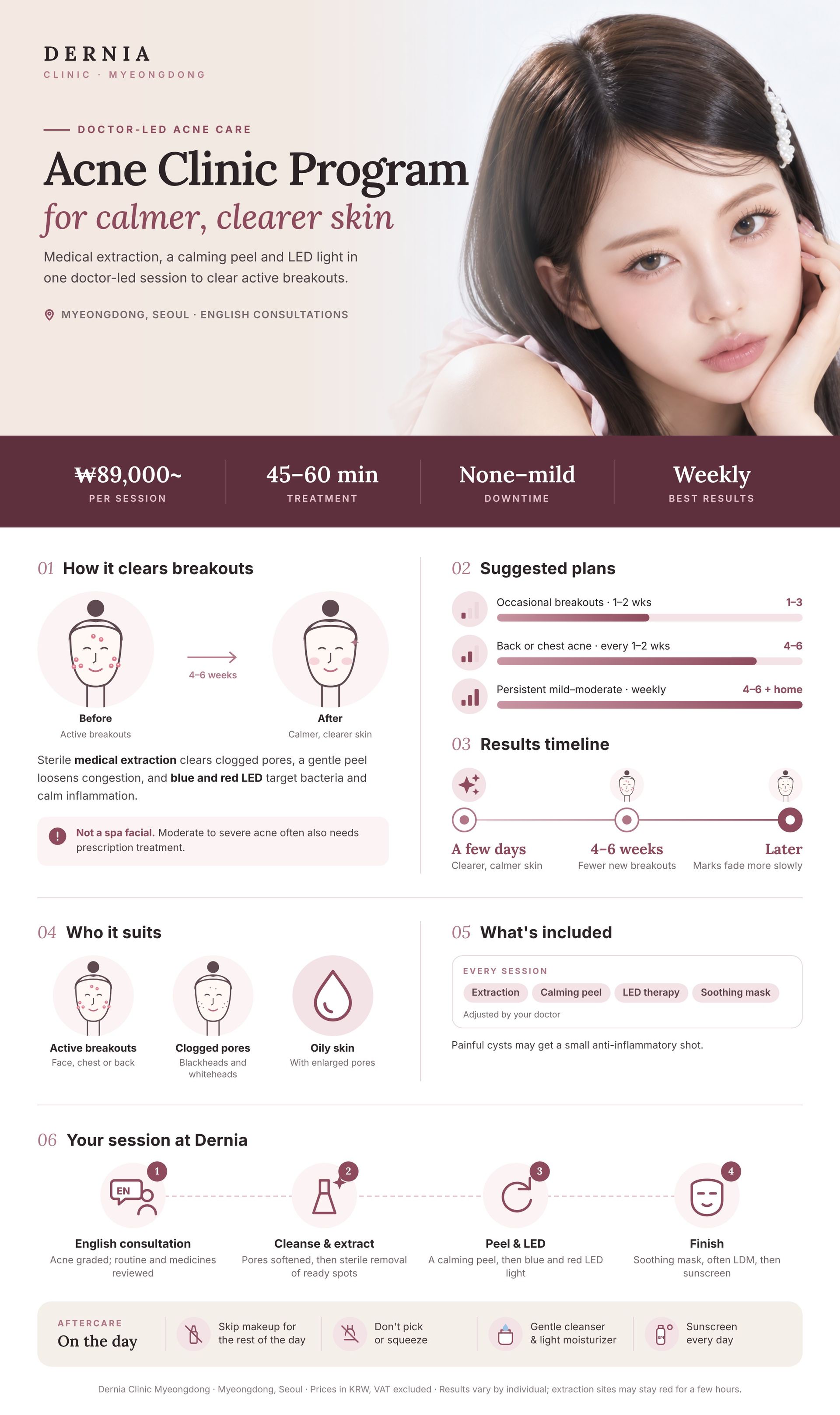 Acne Clinic Program infographic – Dernia Clinic Myeongdong Acne Clinic Program in Myeongdong, Seoul infographic: price, how it works, results timeline and aftercare at Dernia Clinic