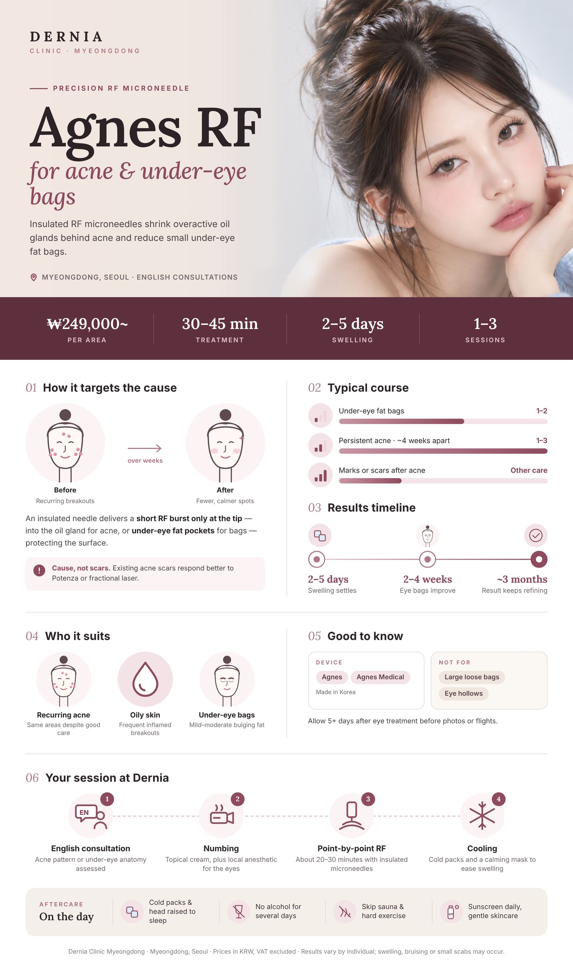 Agnes RF in Myeongdong, Seoul infographic: price, how it works, results timeline and aftercare at Dernia Clinic