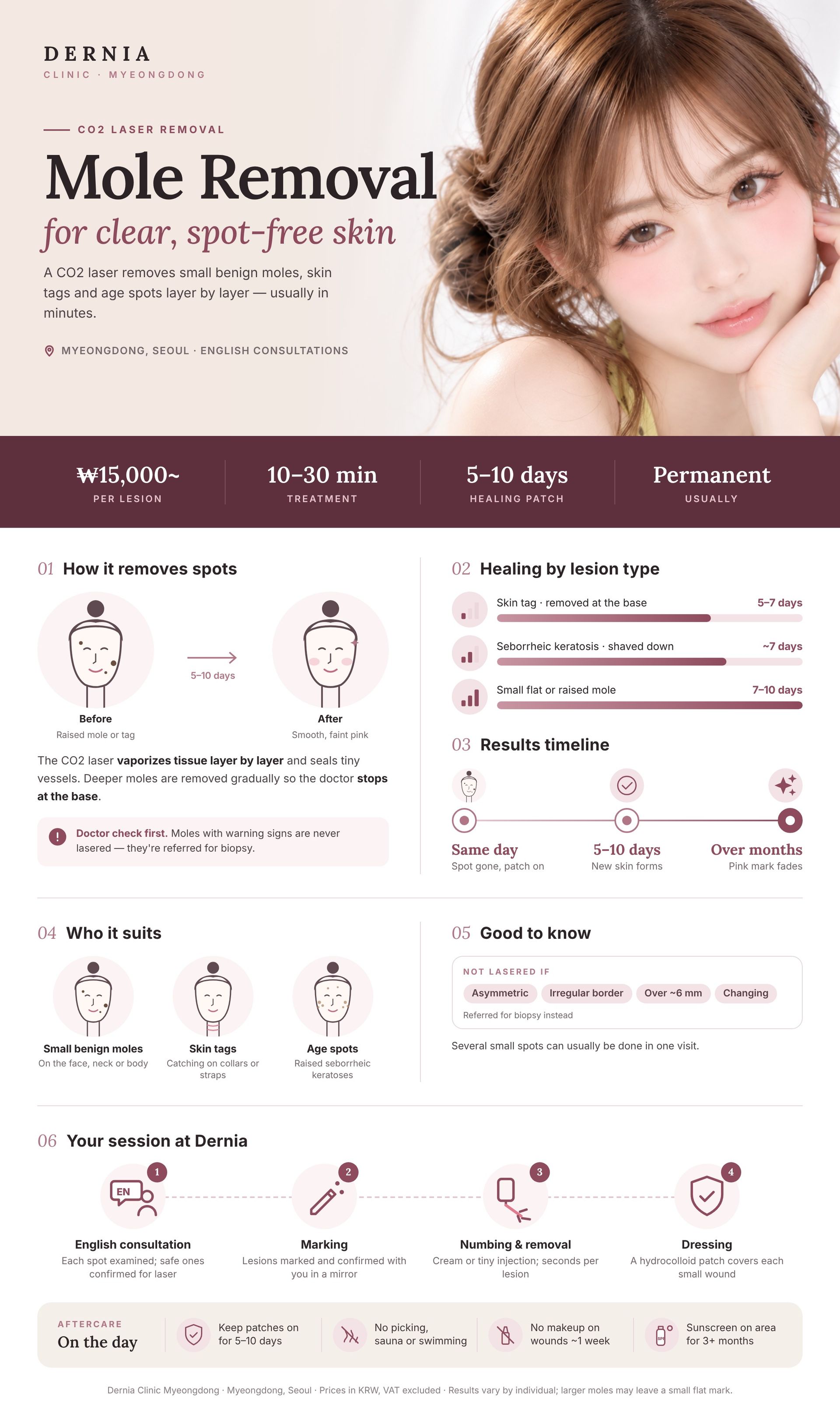 Mole & Skin Tag Removal in Myeongdong, Seoul infographic: price, how it works, results timeline and aftercare at Dernia Clinic