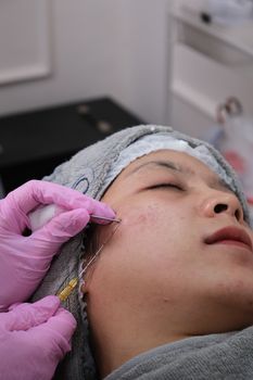 Microneedling treatment on a woman's cheek with a serum being applied