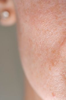 Close-up of smooth, refined skin texture on a cheek