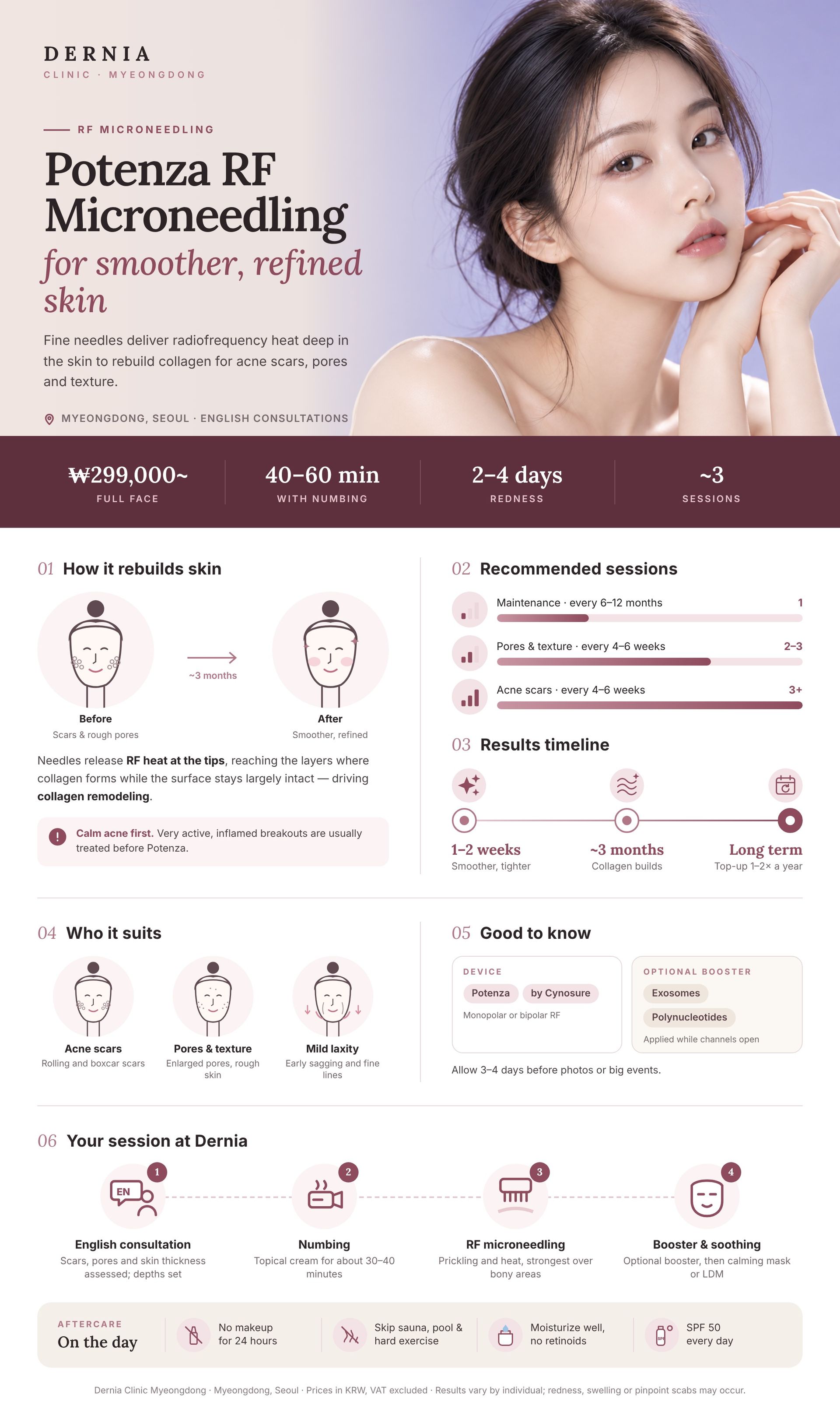 Potenza RF Microneedling infographic – Dernia Clinic Myeongdong Potenza RF Microneedling in Myeongdong, Seoul infographic: price, how it works, results timeline and aftercare at Dernia Clinic
