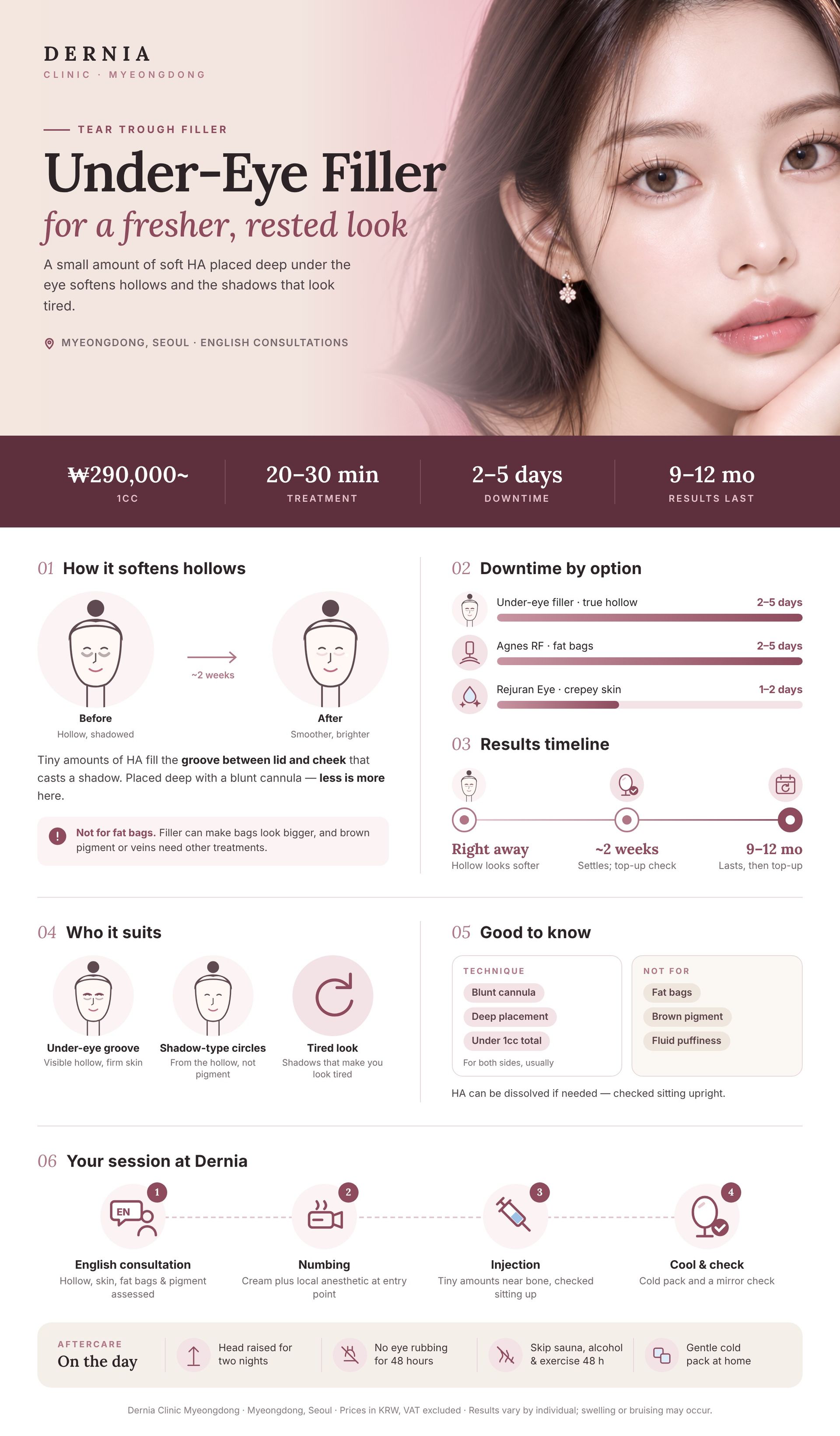Under-Eye (Tear Trough) Filler in Myeongdong, Seoul infographic: price, how it works, results timeline and aftercare at Dernia Clinic