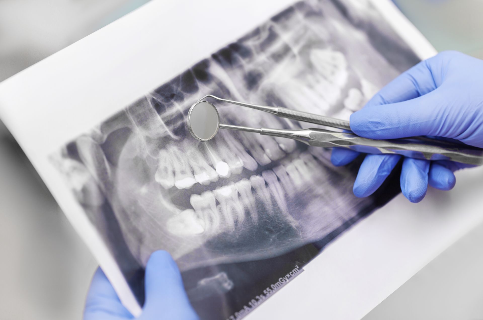 dental x-ray