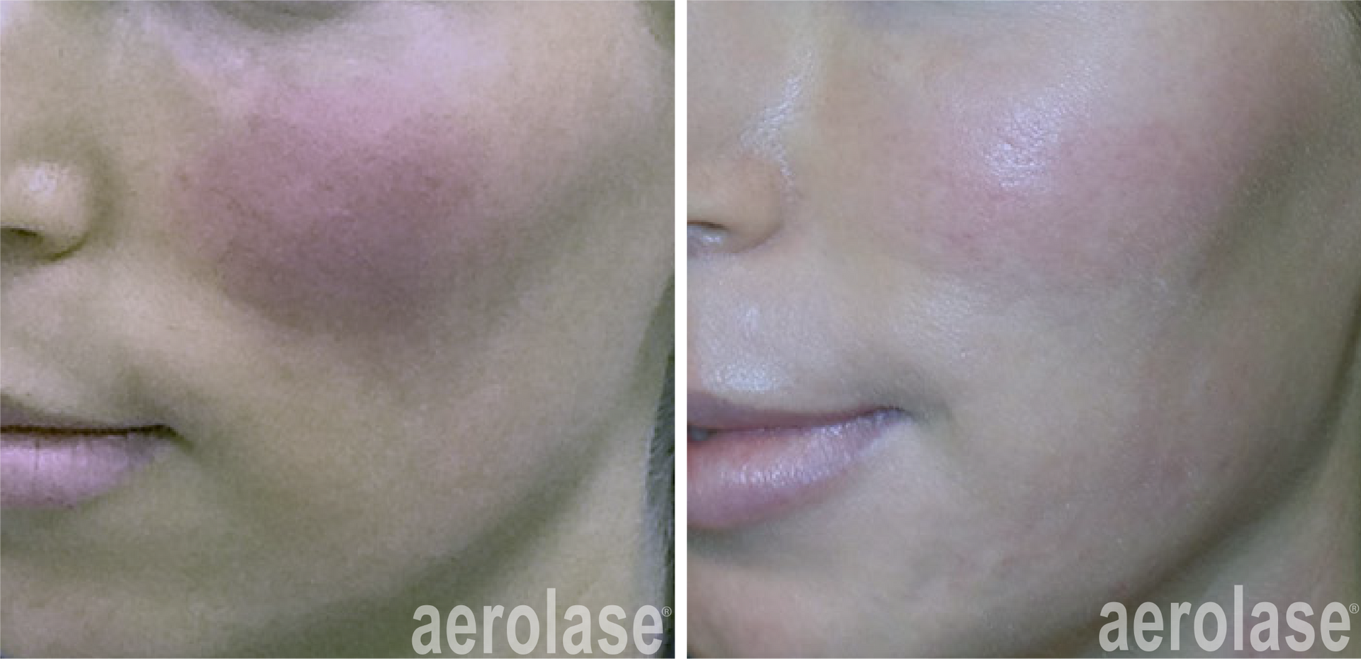 Woman's Face — Greenwood, IN — Vigor Health and Beauty Woman's Face — Greenwood, IN — Vigor Health and Beauty