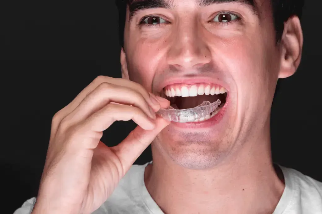 A man is holding a clear braces in his mouth.