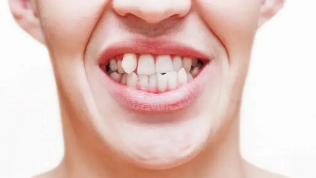 A close up of a person 's mouth with their teeth showing.