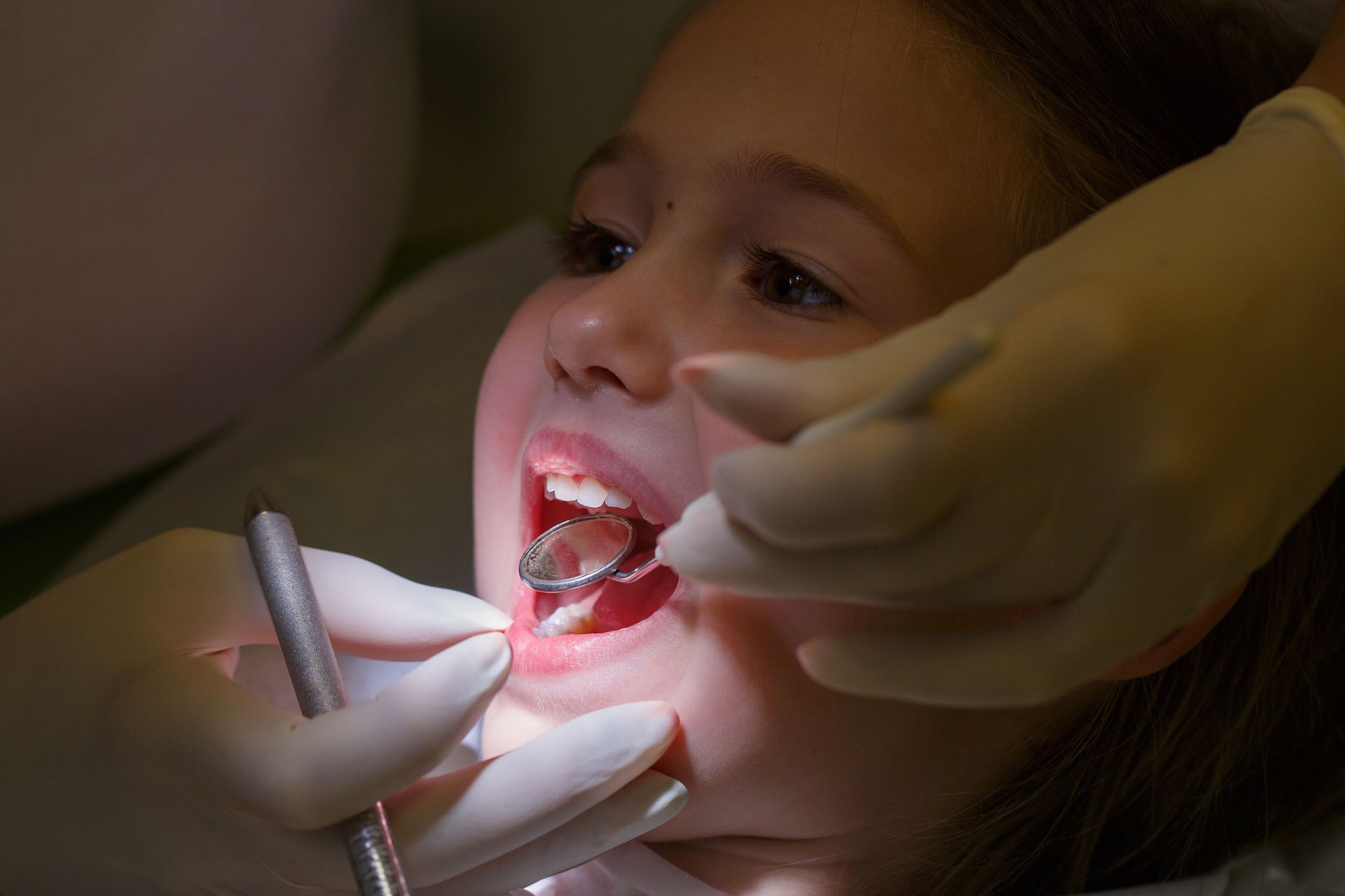 A young girl at a pediatric dentist's office being examined for white filling treatment.