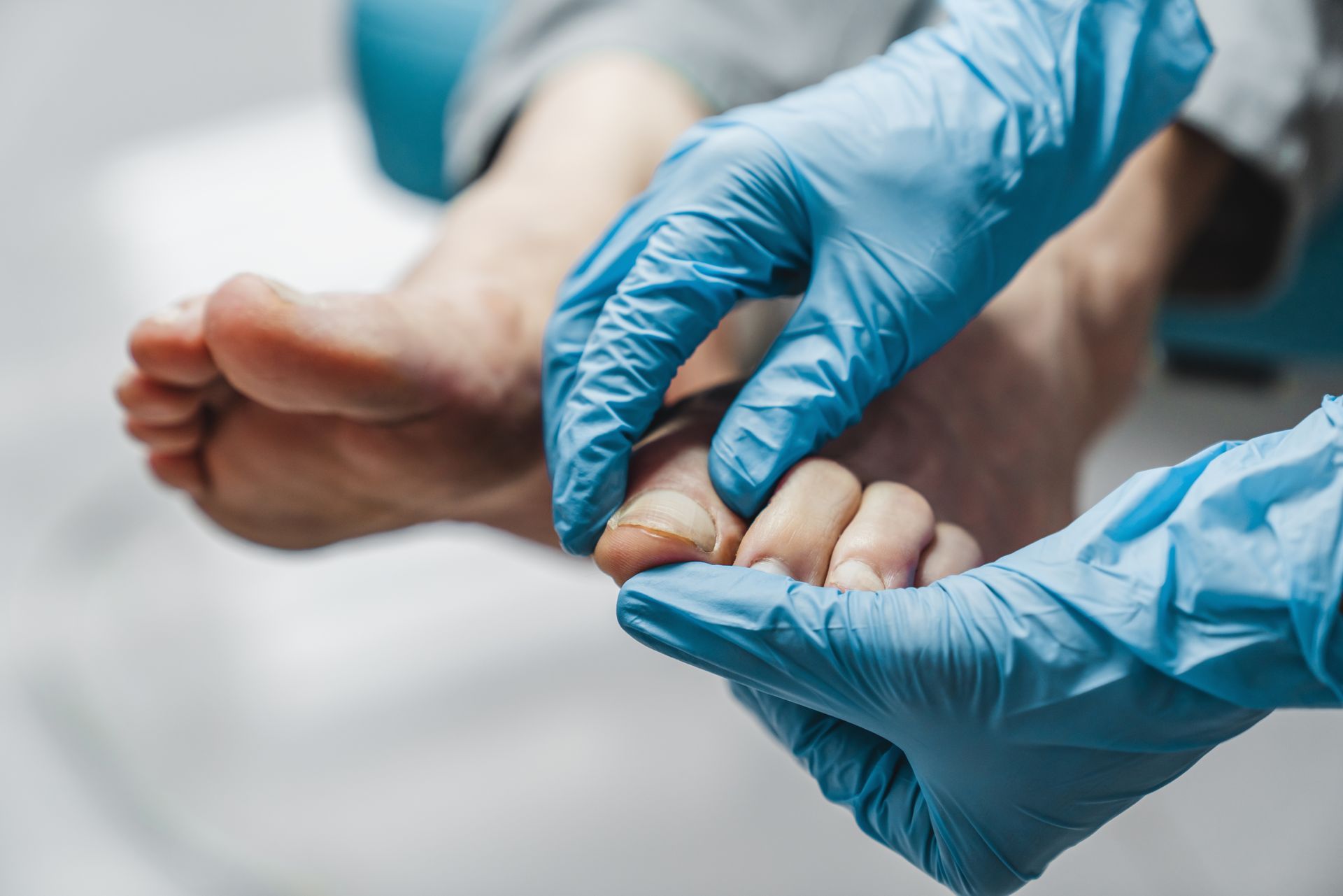 Hands in blue gloves examining toes. Close-up view of foot examination in a medical setting.