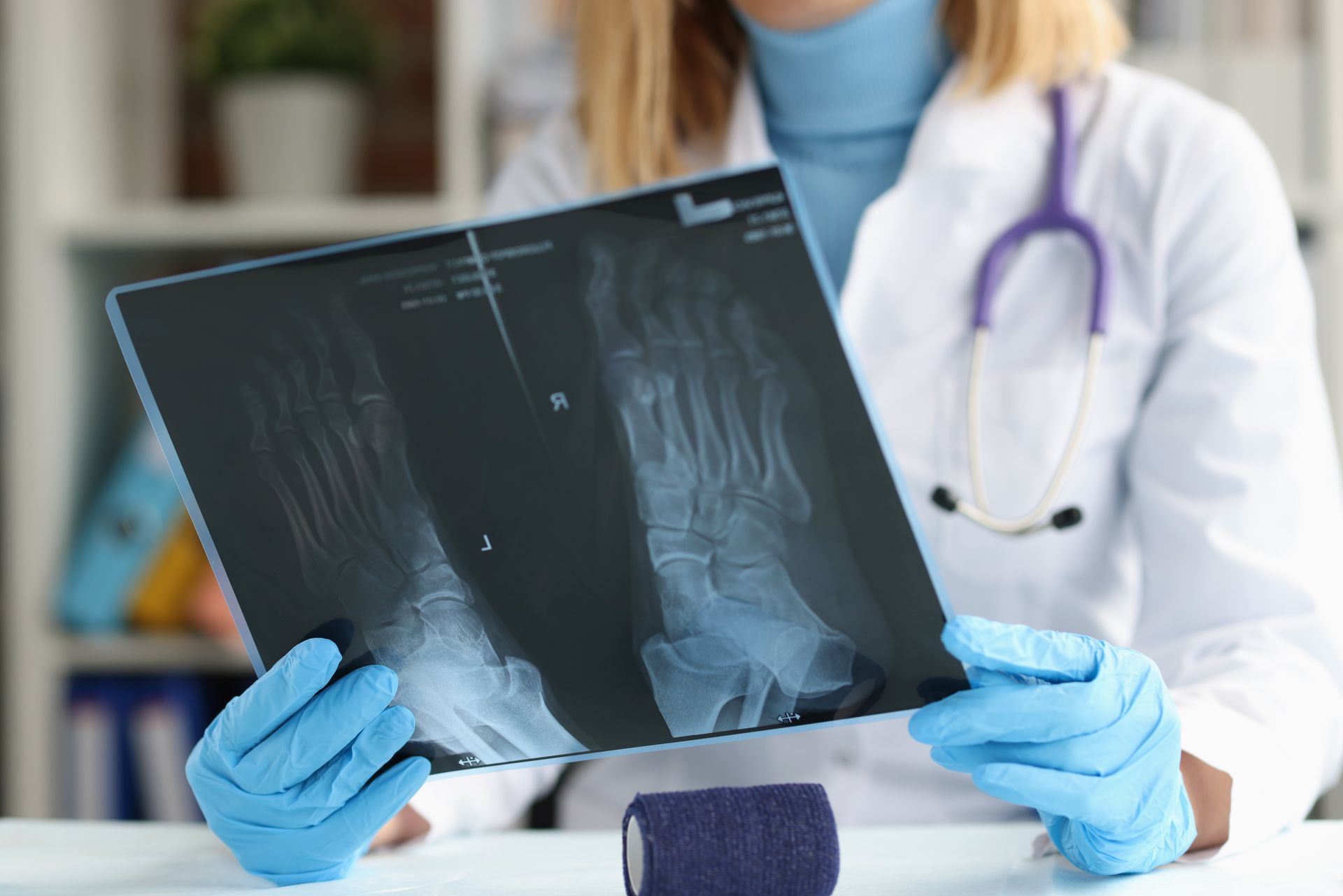 Doctor examining foot x-ray; wearing gloves, white coat, and stethoscope. Bandage on desk.