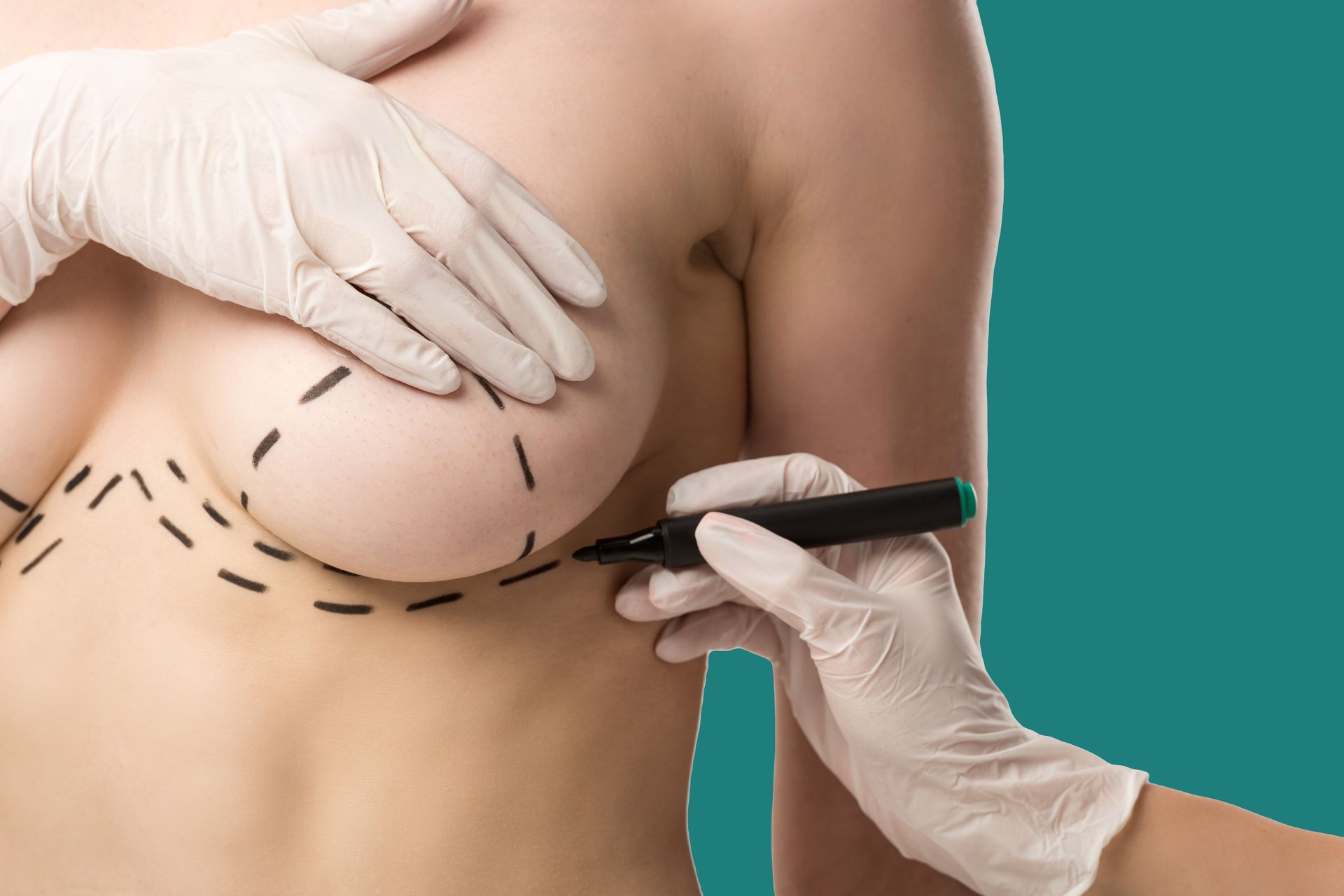 Person receiving a facial injection in a medical setting.