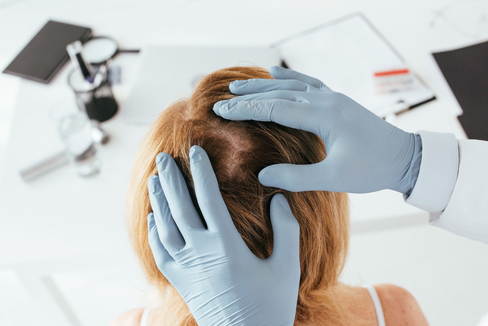 Gloved hands examining a person’s scalp in a clinic, with medical tools in the background