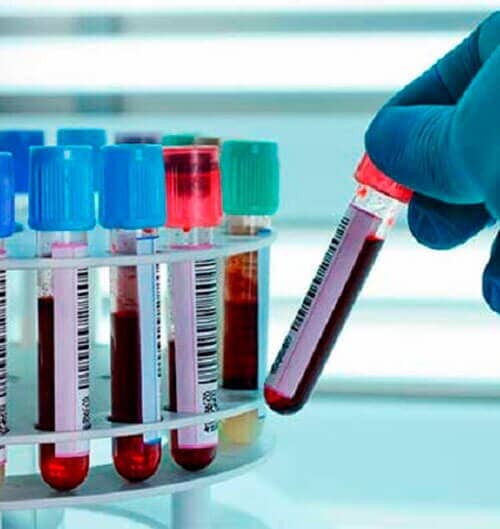 Laboratorio Clínico de las Américas- química clínica