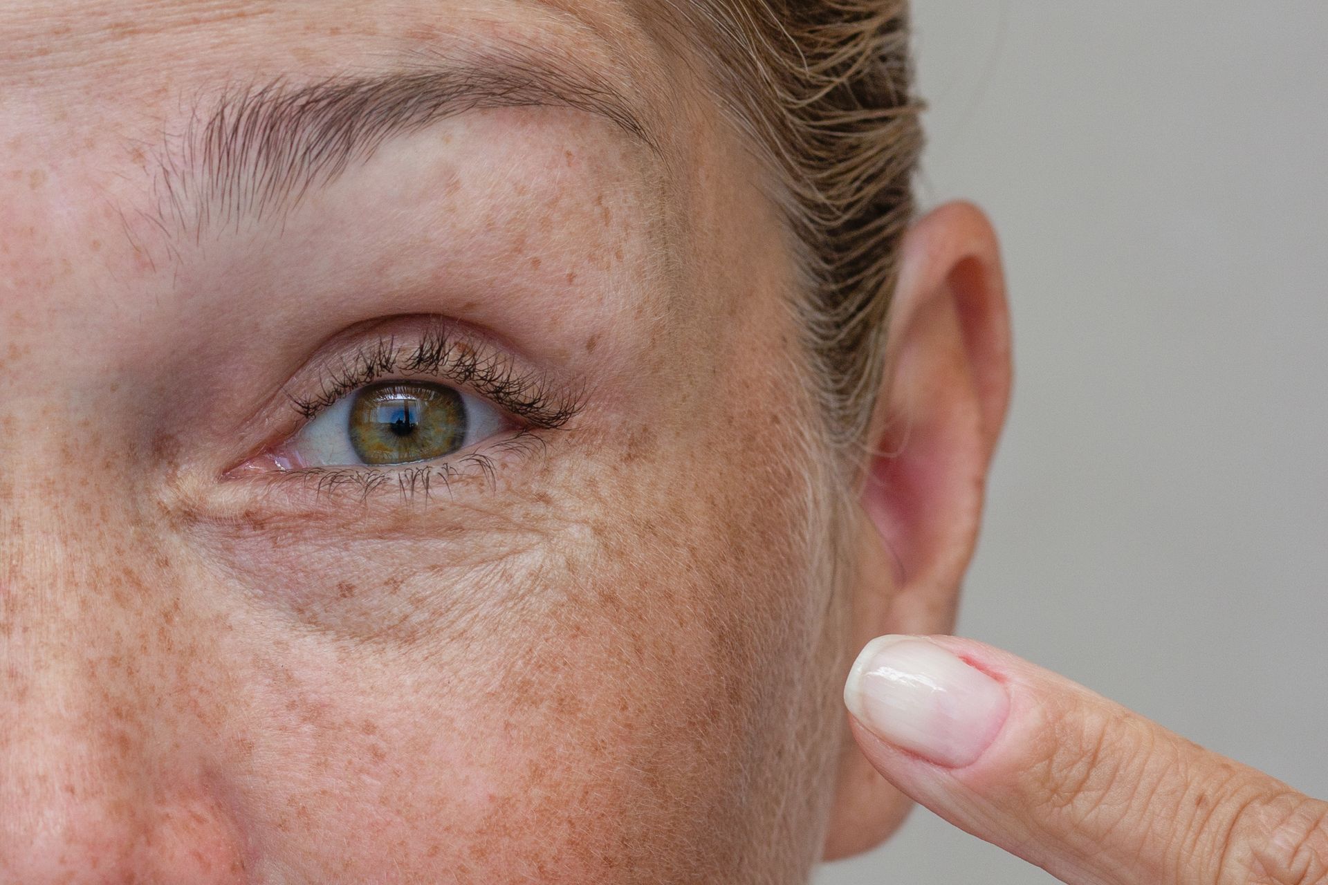 Close-up of an eye with visible crow’s feet while a finger points to the under-eye area