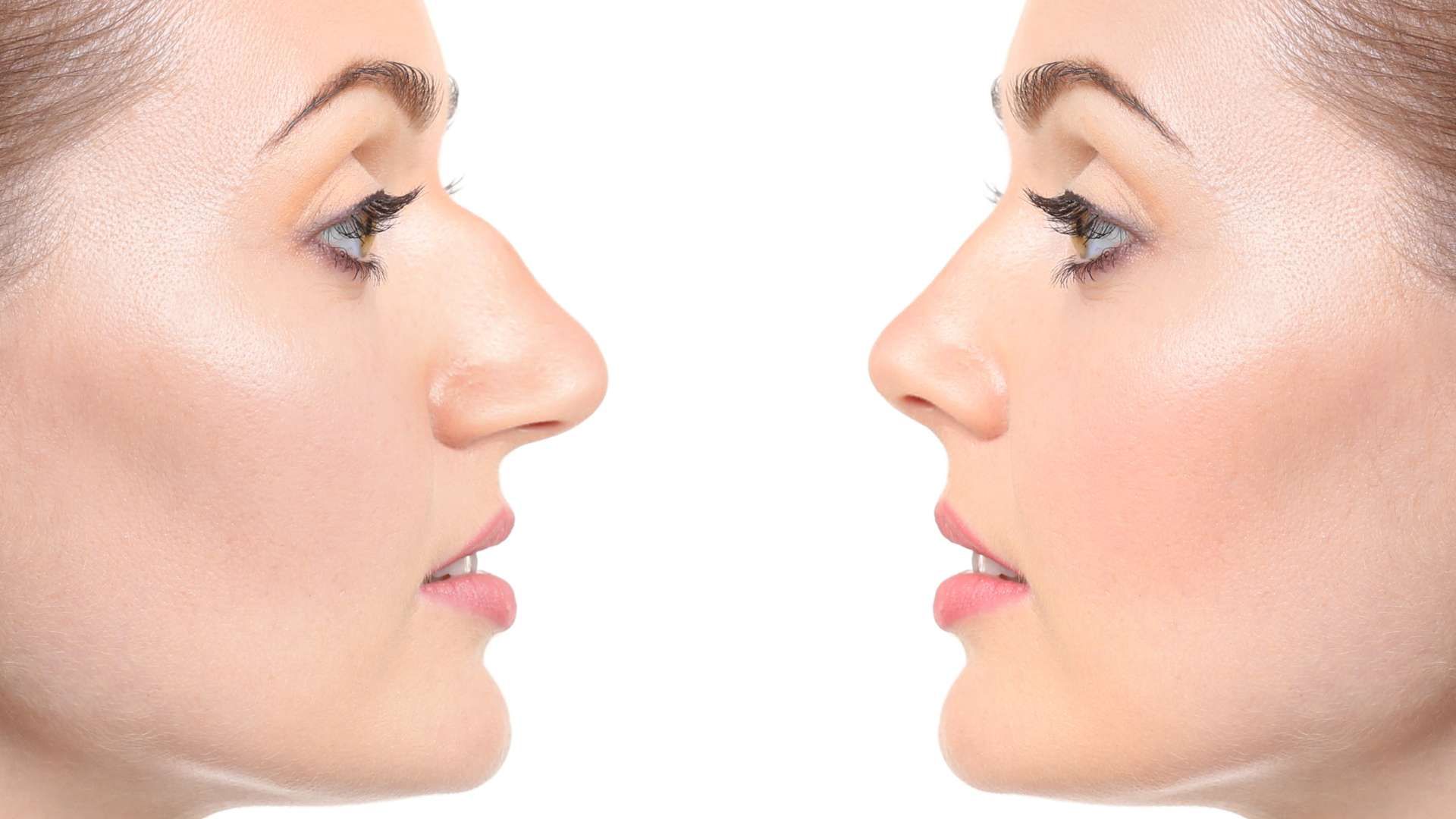 Two side-profile faces facing each other, showing a comparison of nose shape and profile.
