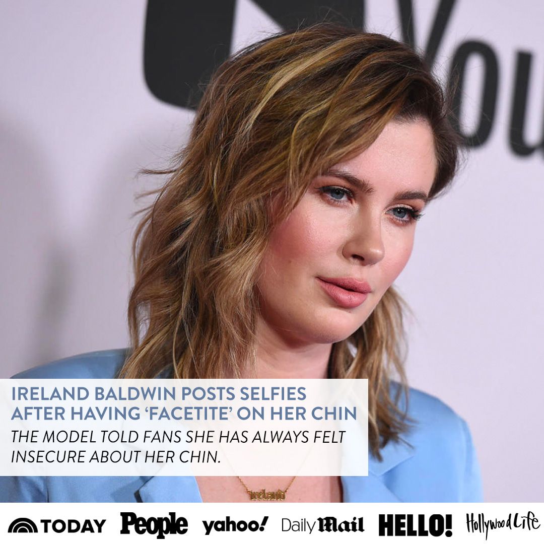 Ireland baldwin posts selfies after having facetite on her chin