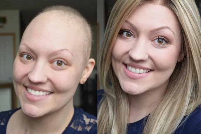 Woman with shaved head, smiling, beside woman with blonde hair and same smile.