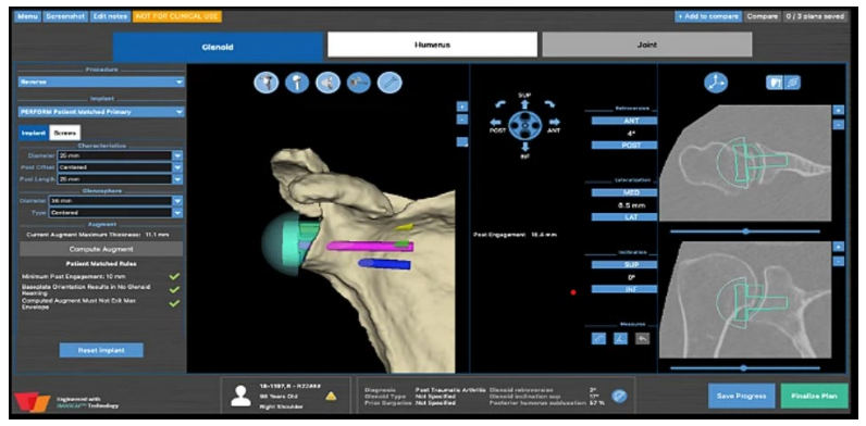 Surgery Outline | AZ Ortho Surgery Outline | AZ Ortho
