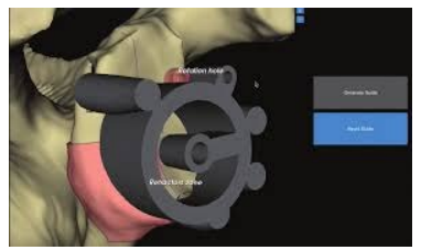 Surgery Approach | AZ Ortho Surgery Approach | AZ Ortho